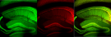 Mouse hippocampal section. Image of hippocampus from a transgenic mouse expressing G-CaMP7 and DsRed2.